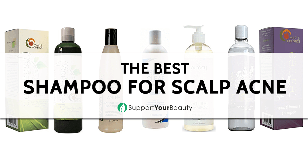 Best Shampoo For Scalp Acne
