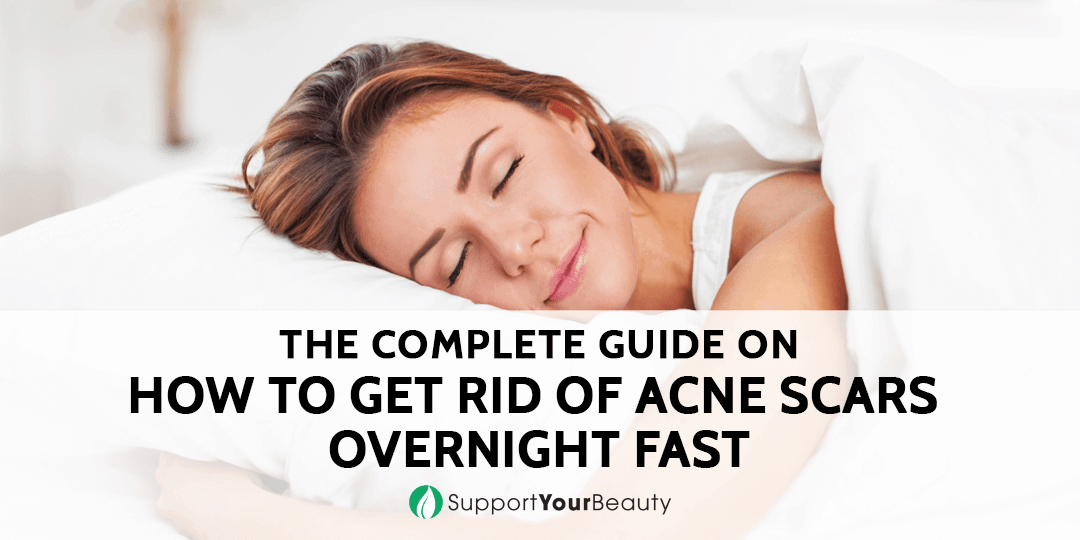 How To Get Rid Of Acne Scars Overnight Fast