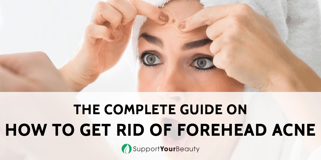 How To Get Rid Of Forehead Acne
