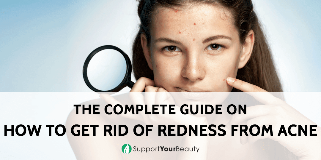 How To Get Rid Of Redness From Acne