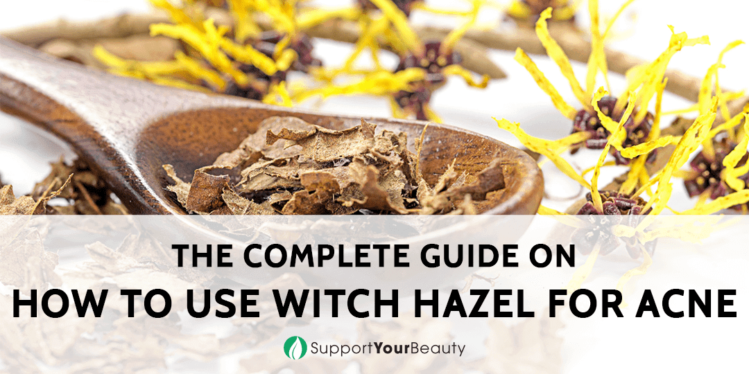 How To Use Witch Hazel For Acne