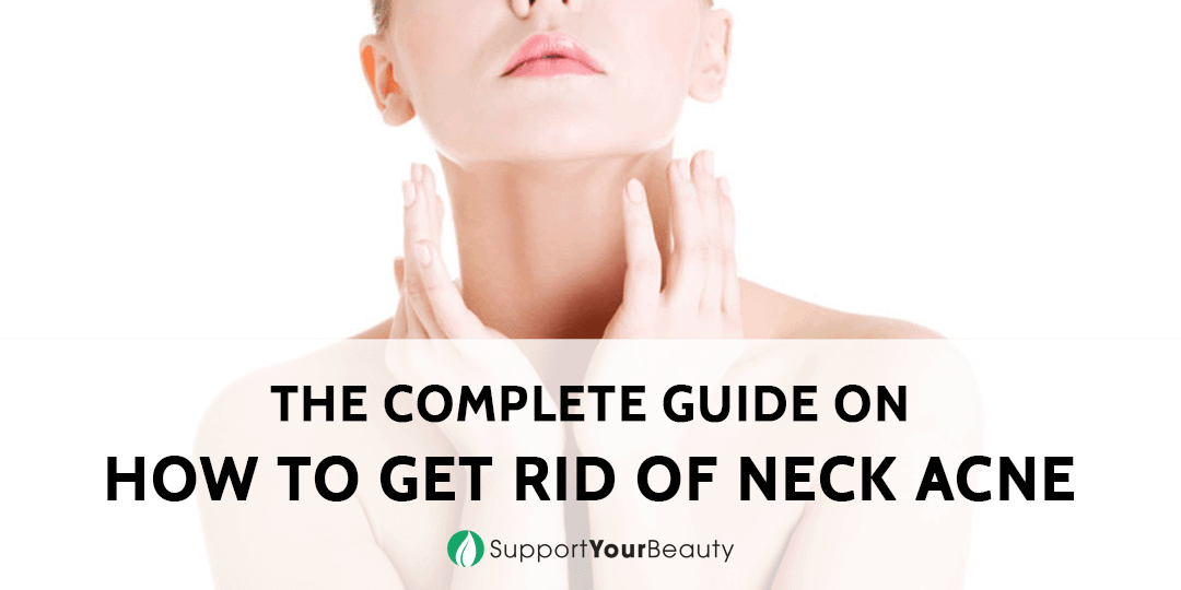How To Get Rid Of Neck Acne