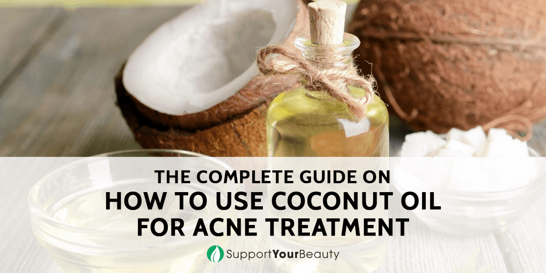 How To Use Coconut Oil For Acne Treatment