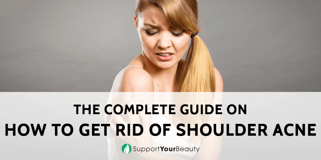 How To Get Rid Of Shoulder Acne (Updated 2023)