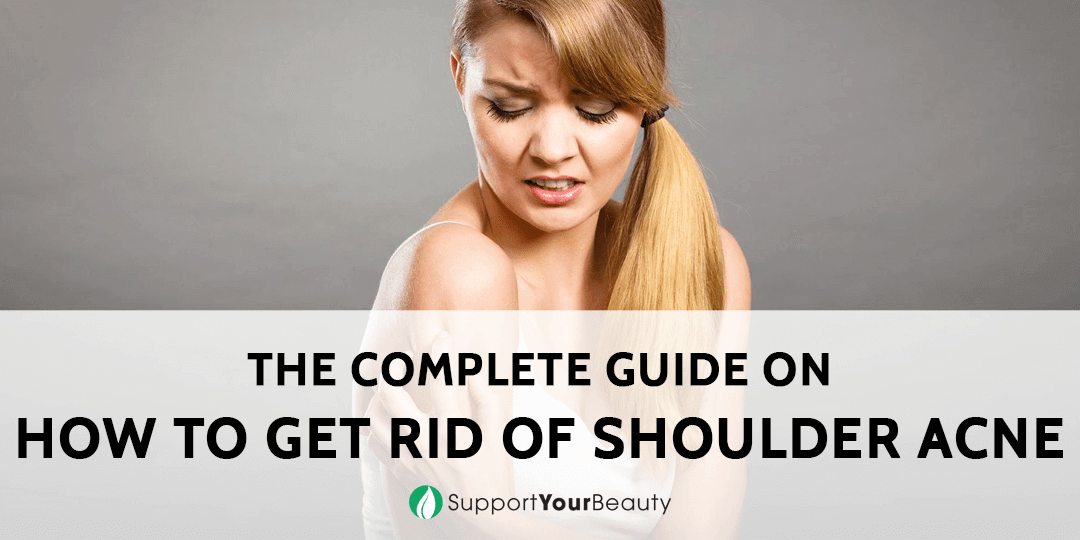 How To Get Rid Of Shoulder Acne