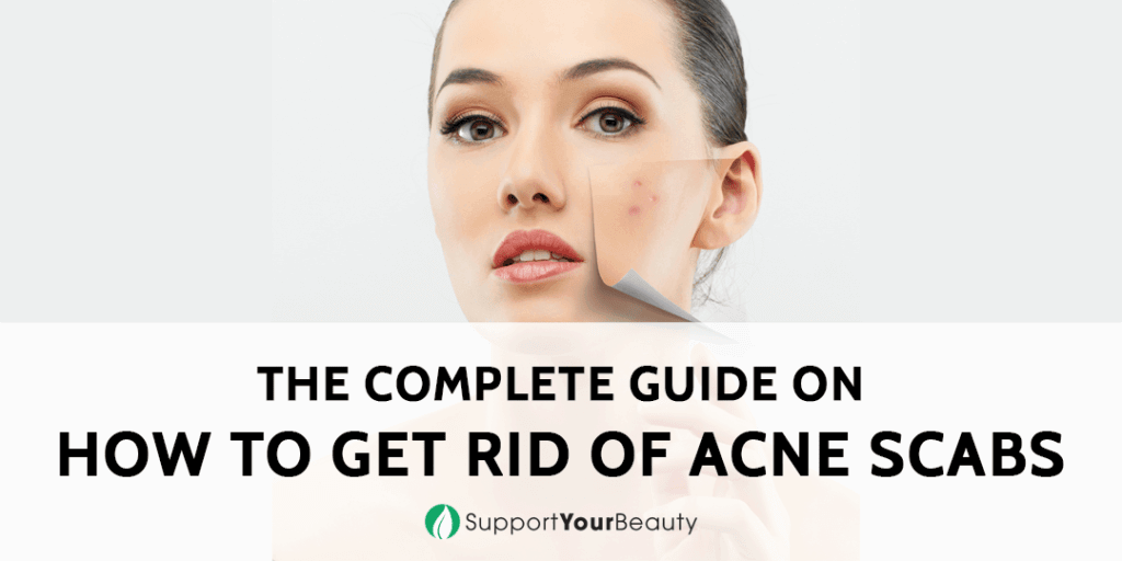 How To Get Rid Of Acne Scabs (2023 Tips)