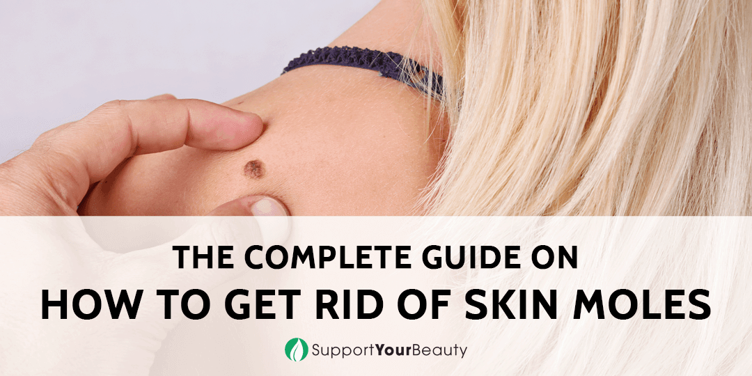 How To Get Rid Of Skin Moles